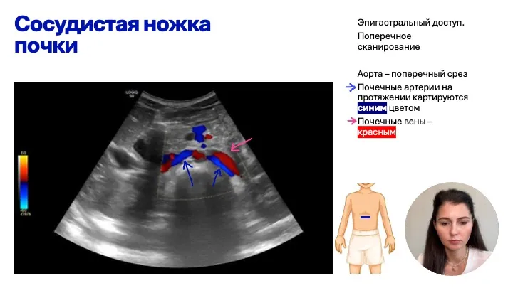 Кровоток почек
