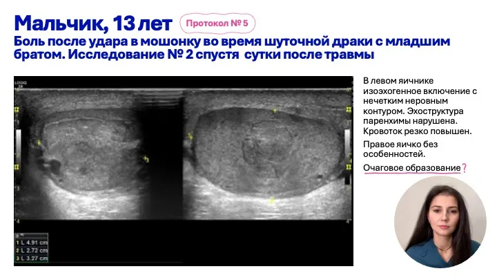 Заболевания органов мошонки у детей