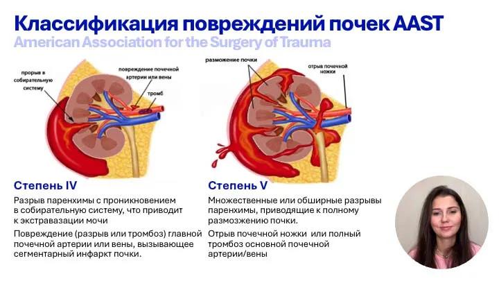 Травма почки